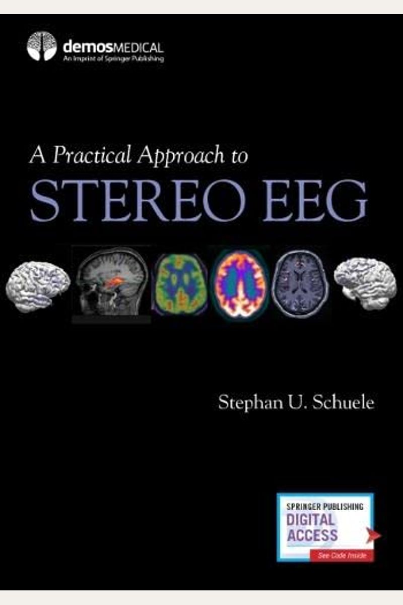 A Practical Approach To Stereo Eeg
