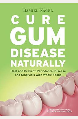 Cure Gum Disease Naturally: Heal Gingivitis and Periodontal Disease with Whole Foods Cure Gum Disease Naturally: Heal Gingivitis and Periodontal Disease with Whole Foods