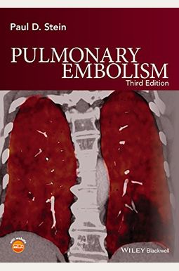 Buy Pulmonary Embolism Book By: Paul D Stein