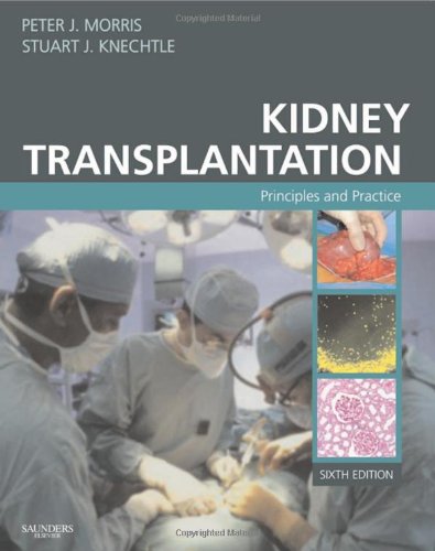 Buy Kidney Transplantation: Principles And Practice Book By: Peter Morris