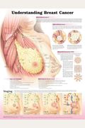 Understanding Breast Cancer 3e Laminated