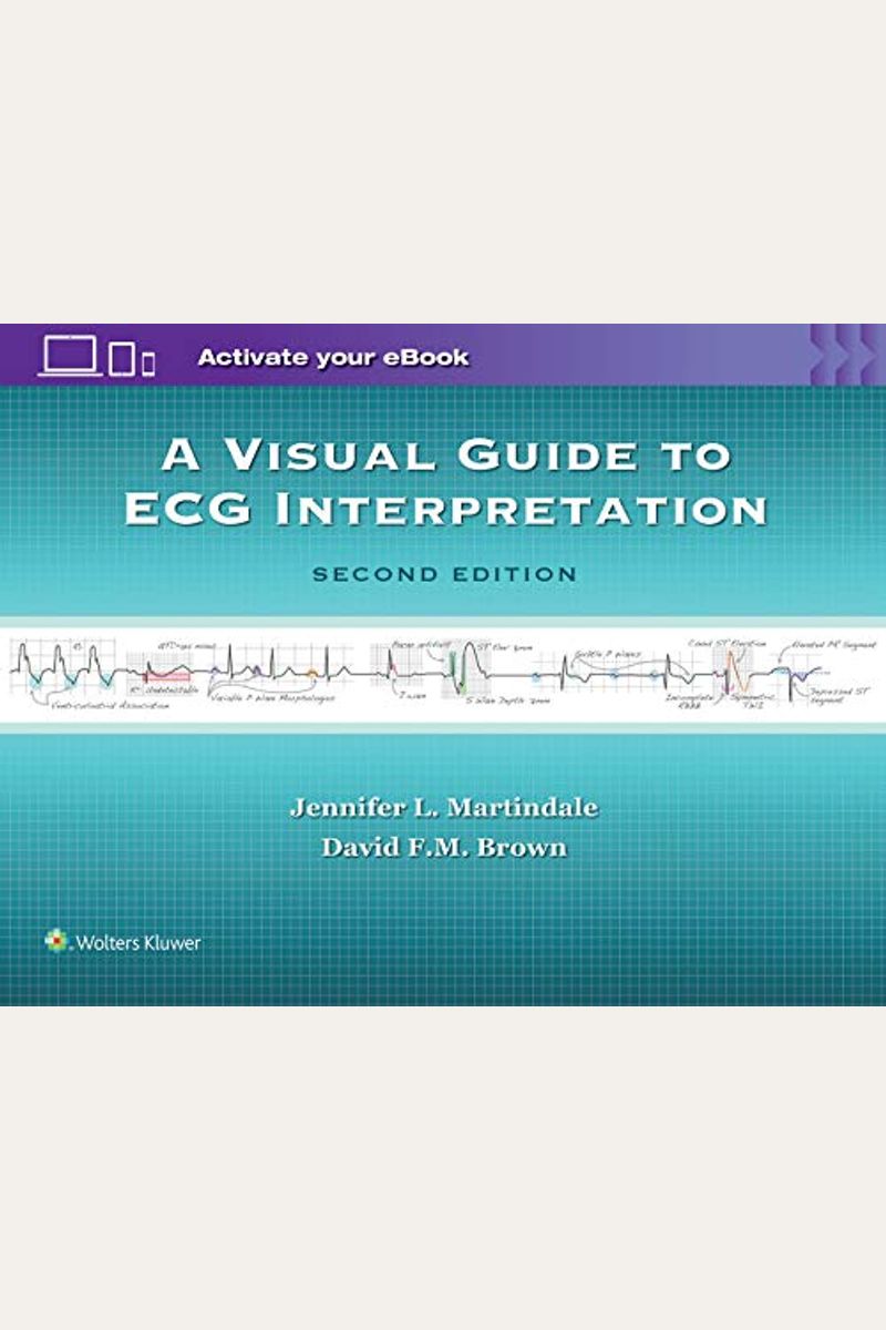 Buy A Visual Guide To Ecg Interpretation Book By: Jennifer L Martindale