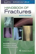 Handbook Of Fractures