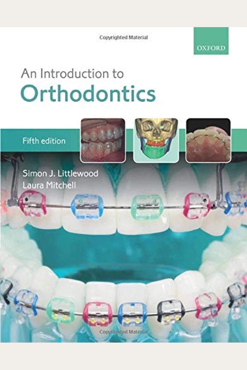 Buy An Introduction To Orthodontics Book By Simon J Littlewood