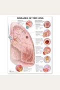 Diseases of the Lung Anatomical Chart