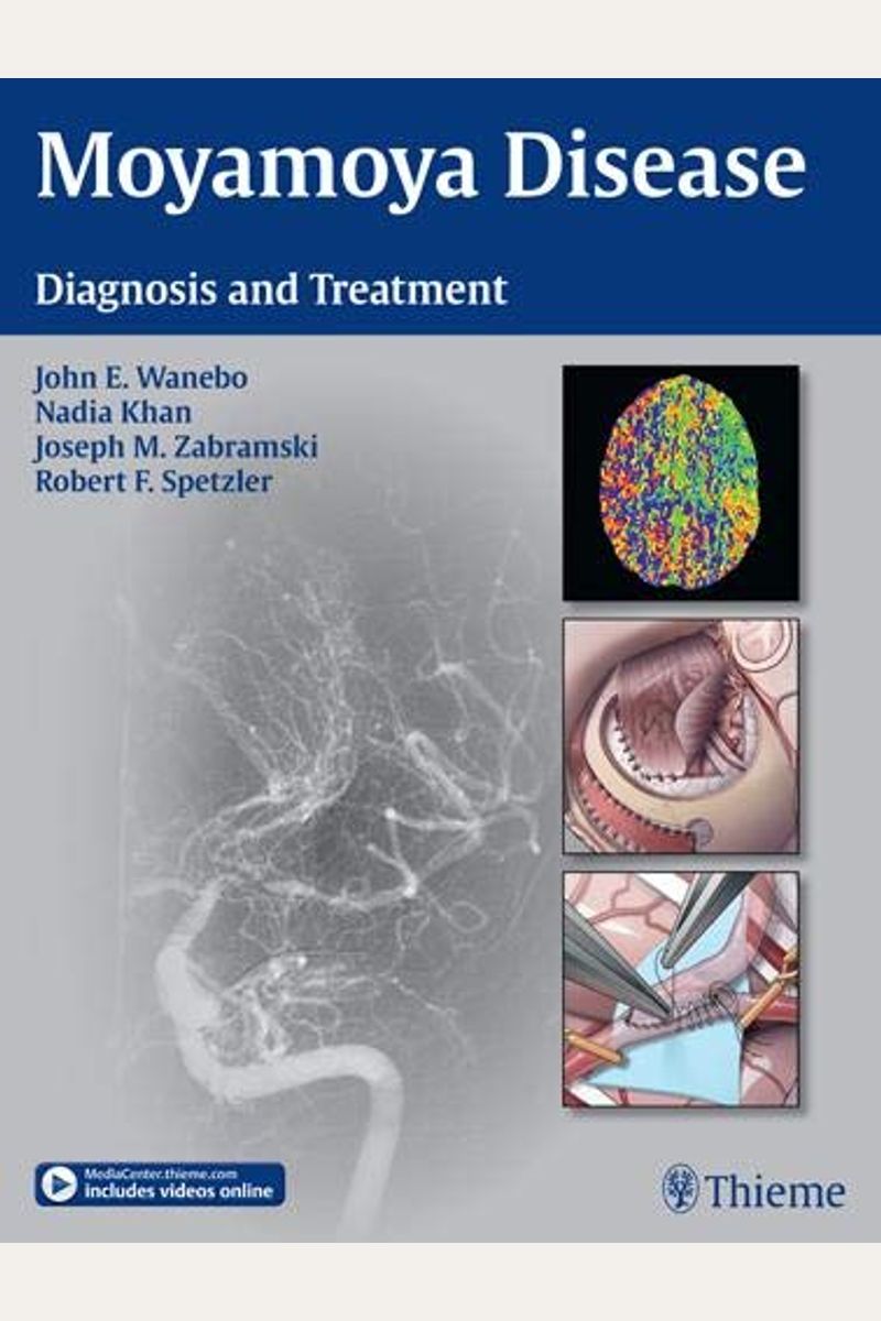 Buy Moyamoya Disease: Diagnosis and Treatment Book By: John E Wanebo