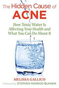 The Hidden Cause Of Acne: How Toxic Water Is Affecting Your Health And What You Can Do About It