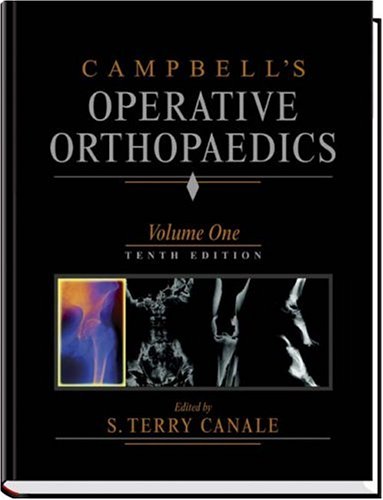 Buy Campbell's Operative Orthopaedics: 4-Volume Set With Cd-Rom 