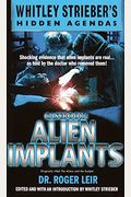 Casebook: Alien Implants