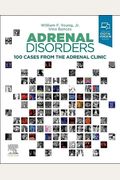Adrenal Disorders: 100 Cases From The Adrenal Clinic